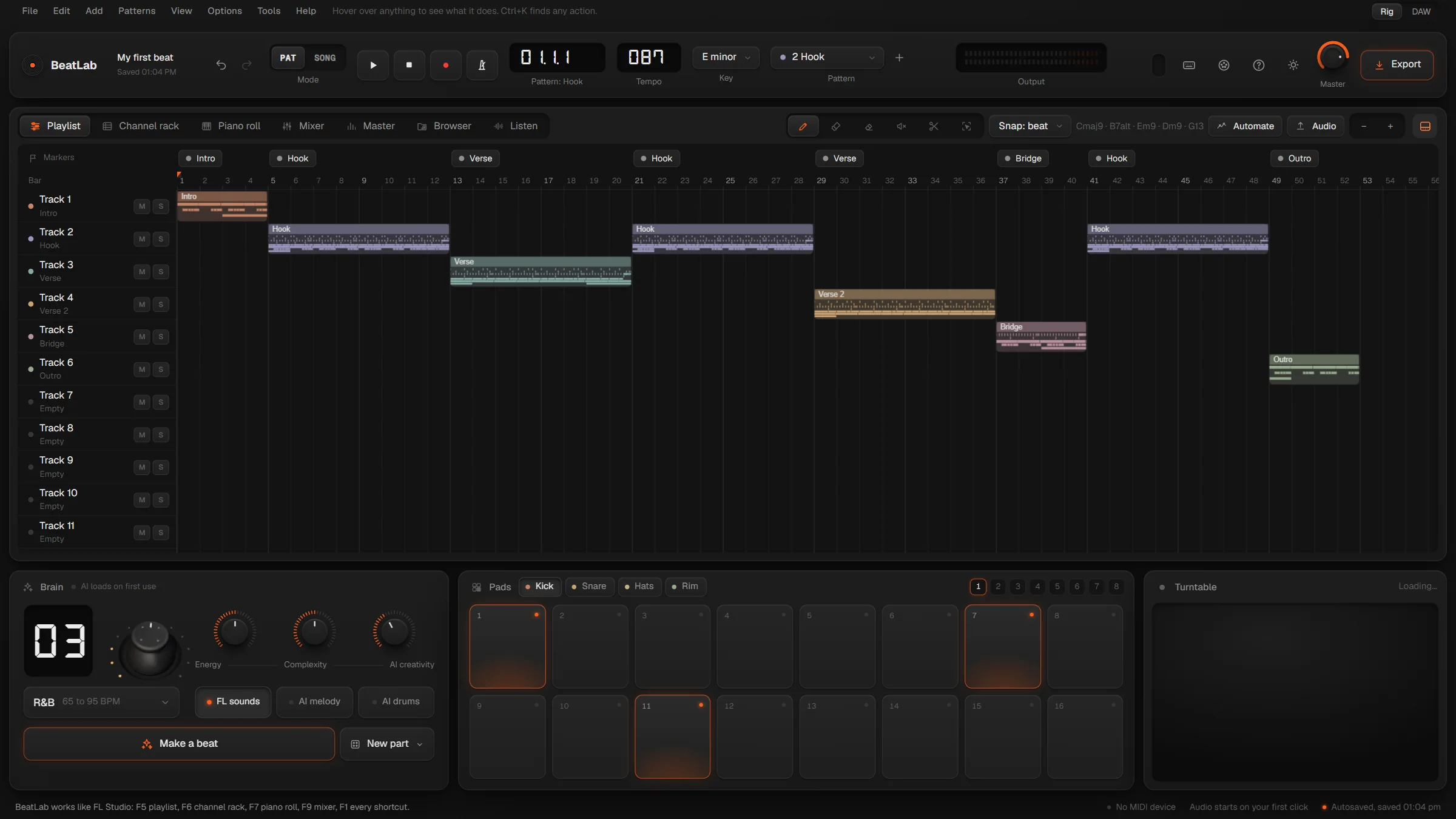 BeatLab in the Rig layout: the playlist on one big screen above the brain, the pads and the turntable